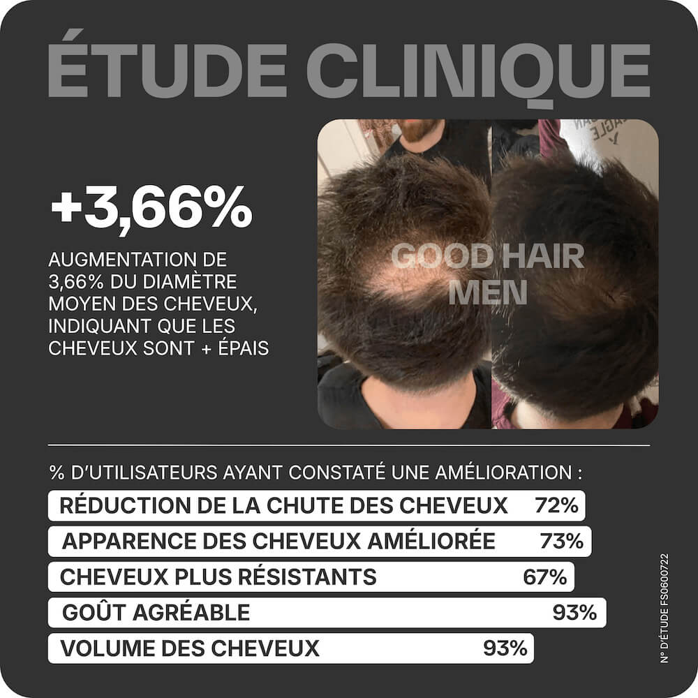 Good Hair Men Tratamiento anticaída para hombres - 3 meses