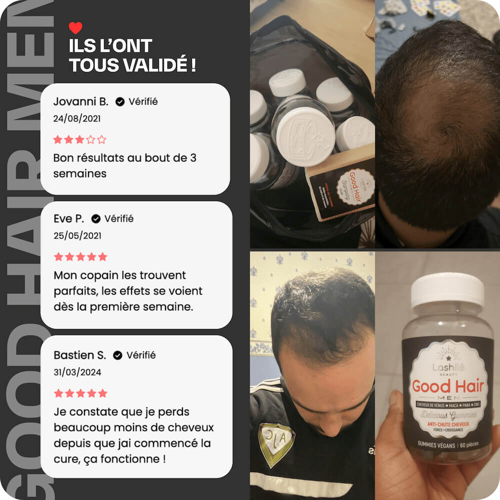 Good Hair Men Tratamiento anticaída para hombres - 3 meses