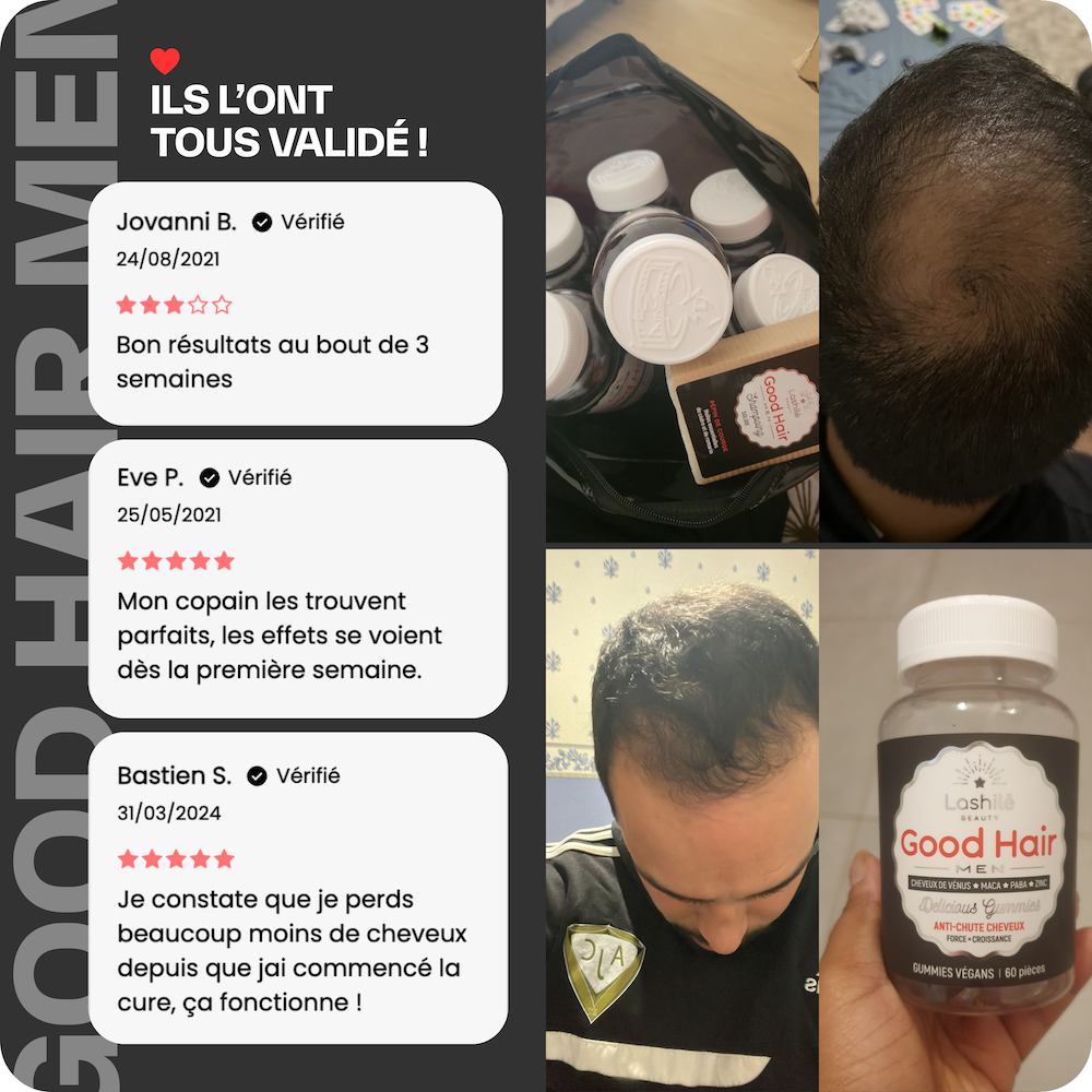 Good Hair Men Trattamento Anti-Caduta per Uomo - 6 Mesi